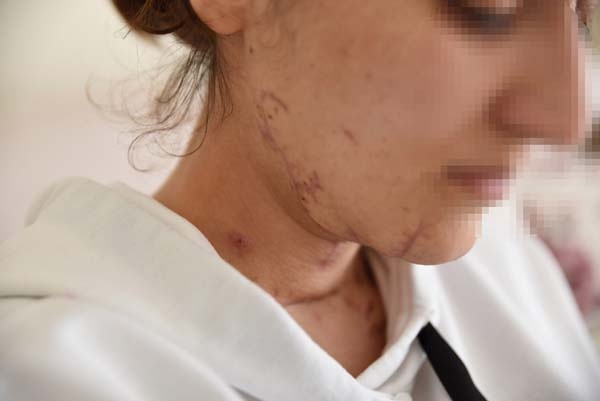 Kan donduran vahşet! Korku filmi gibi... 14