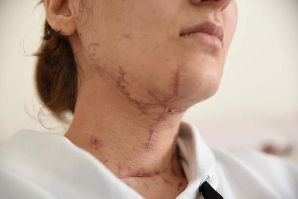 Kan donduran vahşet! Korku filmi gibi... 4