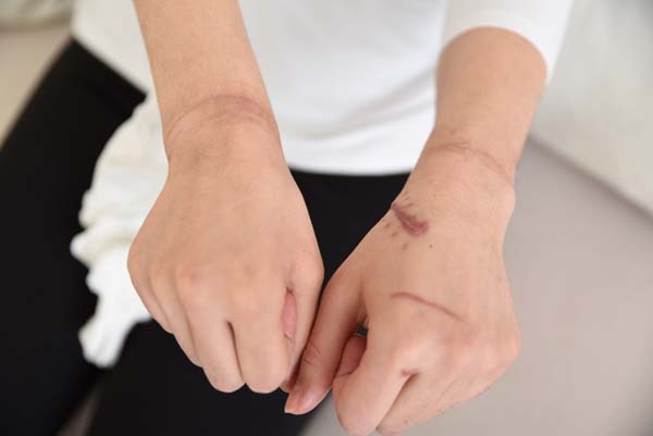 Kan donduran vahşet! Korku filmi gibi... 6