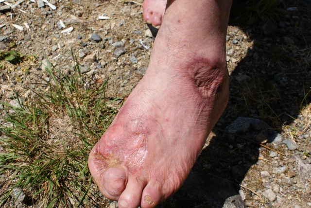 "Uzungöl'de balık tutarken ölebilirsiniz" eylemi 10