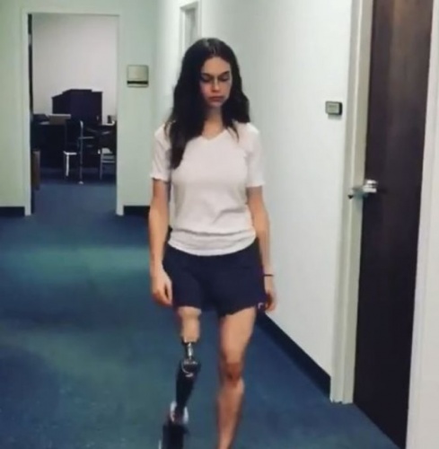 Çocukken kabusu yaşayan Tessa Snyder markaları peşine taktı 3