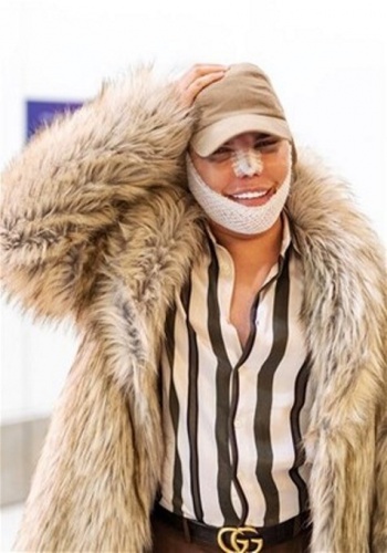 Rodrigo Alvez son haliyle yine şaşırttı 7