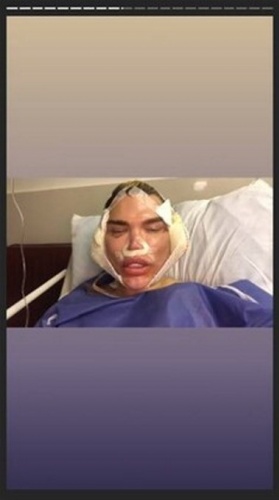 Rodrigo Alvez son haliyle yine şaşırttı 10