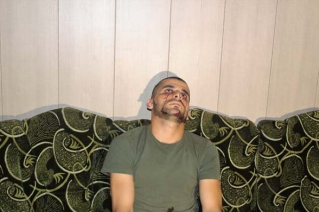 Resmen kan ağlıyor! 2