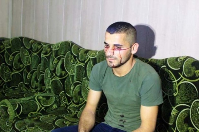 Resmen kan ağlıyor! 3