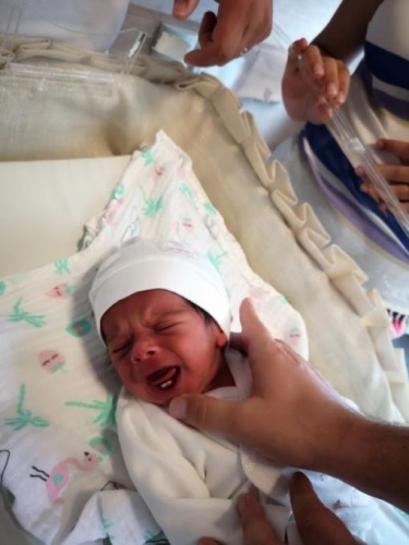 Bebek böyle doğdu! 3 binde bir görülüyor... 2