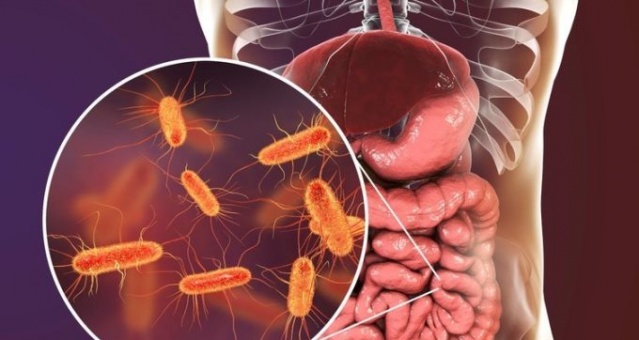 Bu besinler bağırsak kanserinden koruyor 2