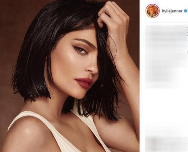 Kylie Jenner ne hastası? Açıkladı 7