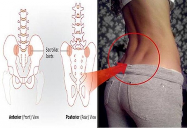 Bel gamzesi bakın ne anlama geliyor? 5