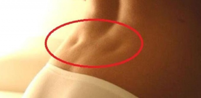 Bel gamzesi bakın ne anlama geliyor? 3