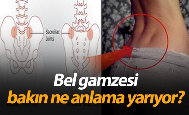 Bel gamzesi bakın ne anlama geliyor? 1