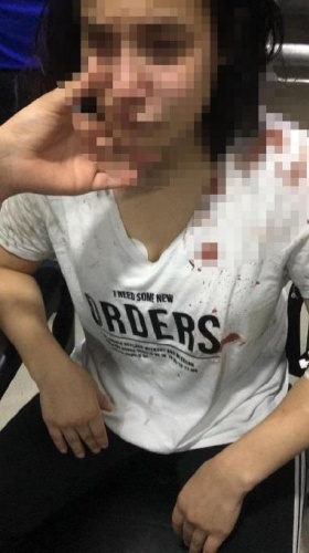 Rize'de öldüresiye dövülen genç kız: Beni öldürecekti 2