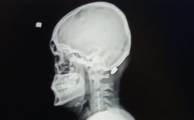 Vakfıkebir'de yaşanan maganda dehşetini anlattı! 2