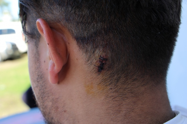 Vakfıkebir'de yaşanan maganda dehşetini anlattı! 6