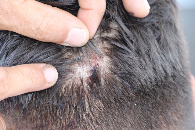 Vakfıkebir'de yaşanan maganda dehşetini anlattı! 8