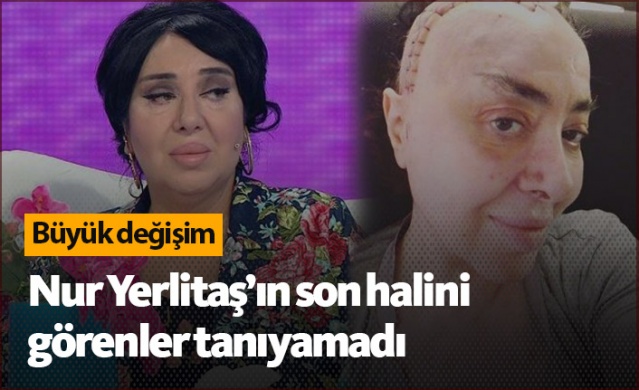 Nur Yerlitaş'ın son hali şaşırttı 1