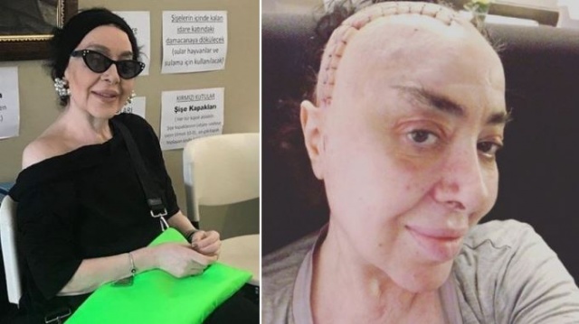 Nur Yerlitaş'ın son hali şaşırttı 2