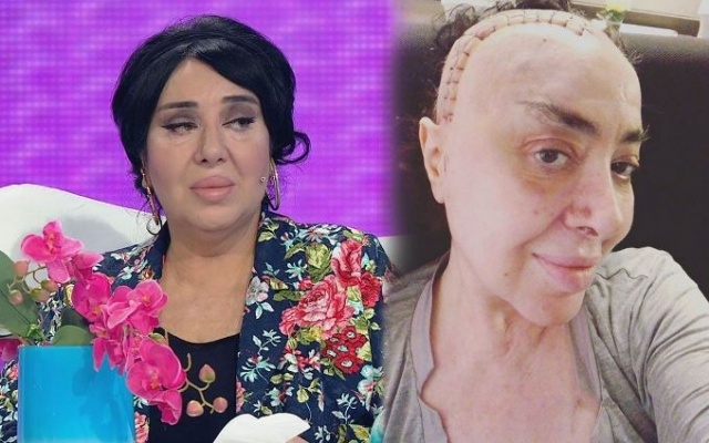 Nur Yerlitaş'ın son hali şaşırttı 3