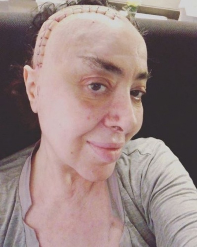 Nur Yerlitaş'ın son hali şaşırttı 5