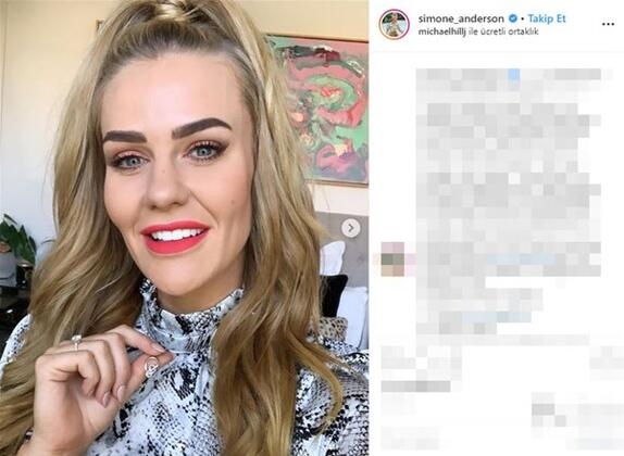 Kilo verince tamamen değişti : Simone Anderson 9