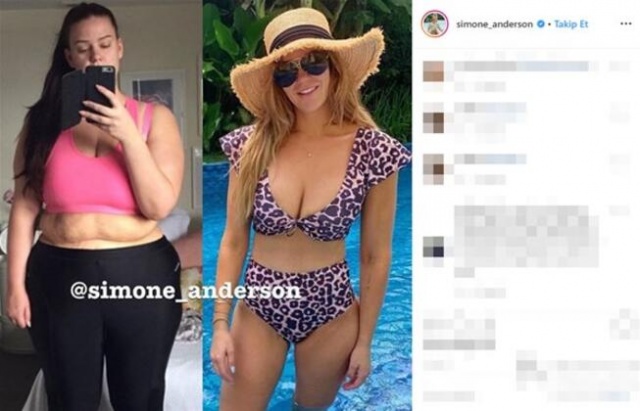 Kilo verince tamamen değişti : Simone Anderson 5