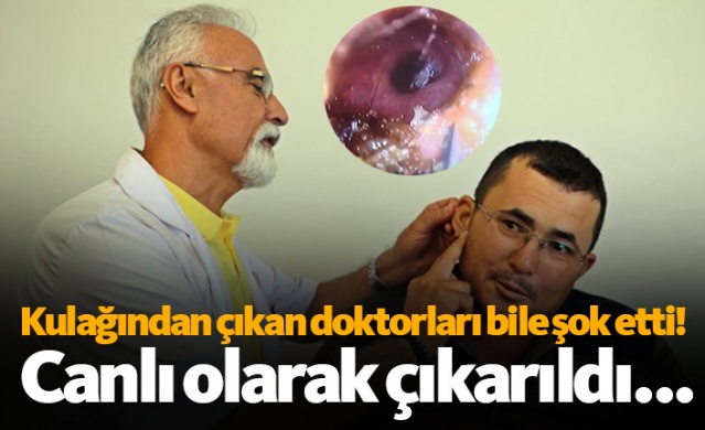 Kulağından canlı olarak çıktı, doktorlar da şaşırdı 1