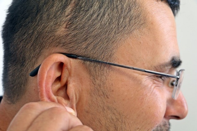 Kulağından canlı olarak çıktı, doktorlar da şaşırdı 2