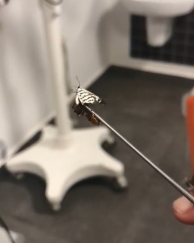 Kulağından canlı olarak çıktı, doktorlar da şaşırdı 7