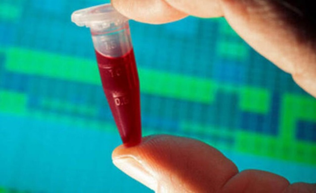 Kansere karşı en dirençli kan grubu açıklandı 7