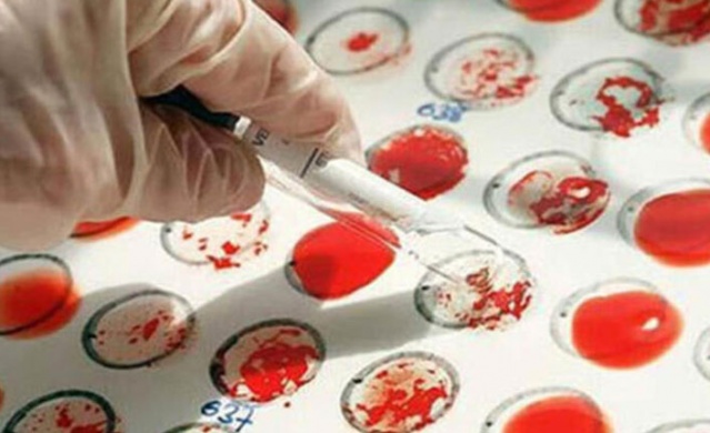 Kansere karşı en dirençli kan grubu açıklandı 5