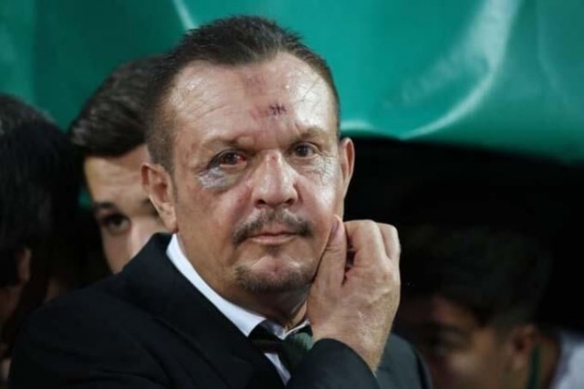 Denizlispor Başkanı Ali Çetin'i gören şok oldu 1