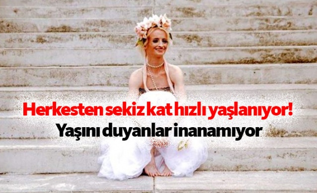 Herkesten sekiz kat hızlı yaşlanıyor! Yaşını duyanlar inanamıyor 1