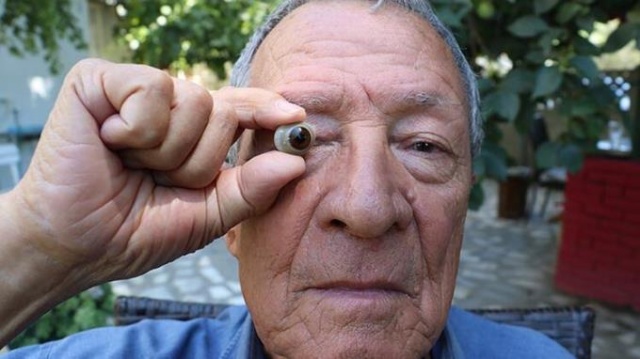 Bu göze "gözü" gibi bakıyor! 9