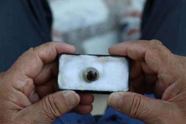 Bu göze "gözü" gibi bakıyor! 3