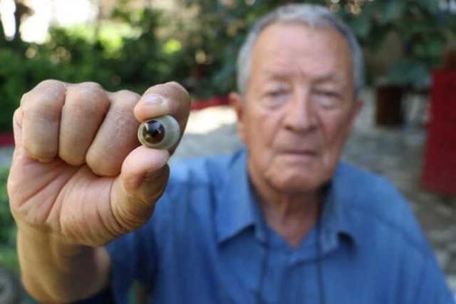 Bu göze "gözü" gibi bakıyor! 4