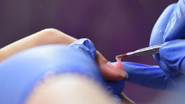 Kalıcı oje uygulaması cilt kanseri riski taşıyor! 4