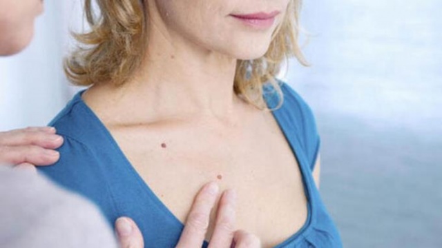 Kalıcı oje uygulaması cilt kanseri riski taşıyor! 5