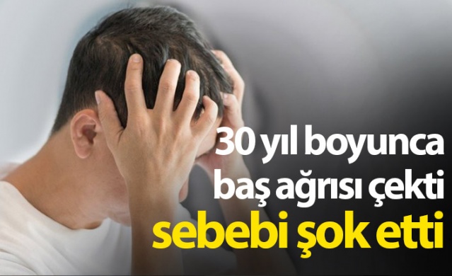 30 yıl boyunca baş ağrısı çekti sebebi şok etti. Foto Galeri 1