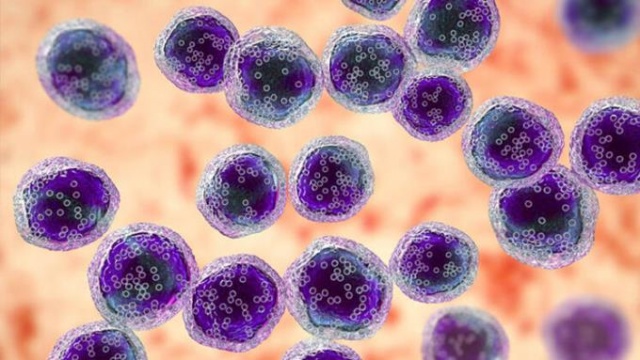 Gece terlemesi  hangi hastalığın işareti? 8