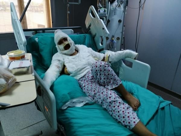 Cezaevinden izinli çıktı, eski eşini yağ ile yaktı 1