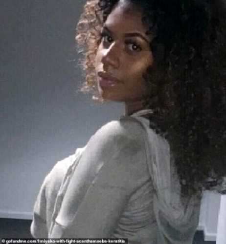 Gözünde lensle denize giren genç kızın hayatı kabusa döndü! 3