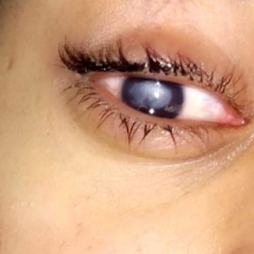 Gözünde lensle denize giren genç kızın hayatı kabusa döndü! 6