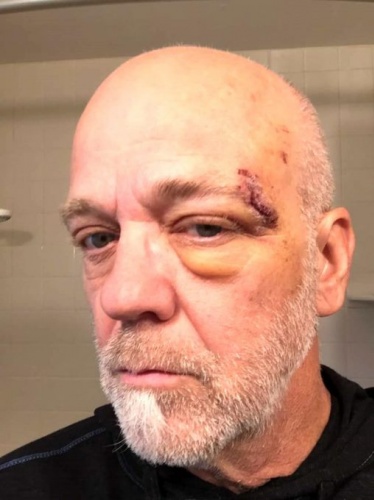 Akıllı saat sayesinde hayatı kurtuldu! 7