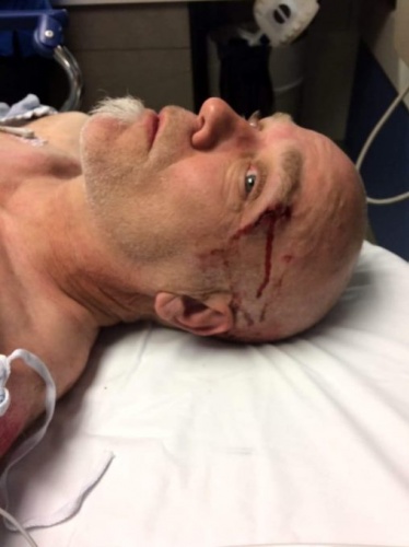 Akıllı saat sayesinde hayatı kurtuldu! 5