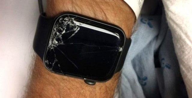 Akıllı saat sayesinde hayatı kurtuldu! 4