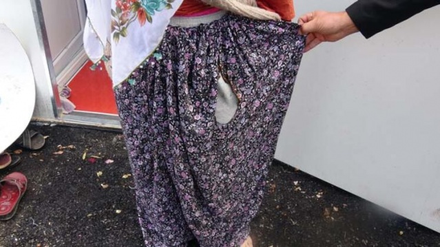 Lanet gibi... Gazeteciler çekim yaparken elbiseleri yanmaya başladı! 10