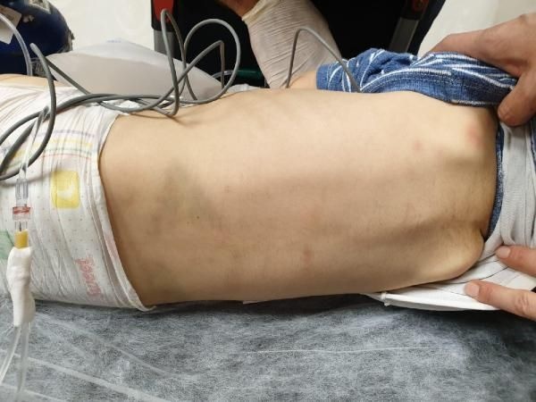 Şok gerçek ortaya çıktı!  Onu bu hale üvey annesi getirdi... 5