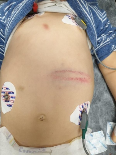 Şok gerçek ortaya çıktı!  Onu bu hale üvey annesi getirdi... 2