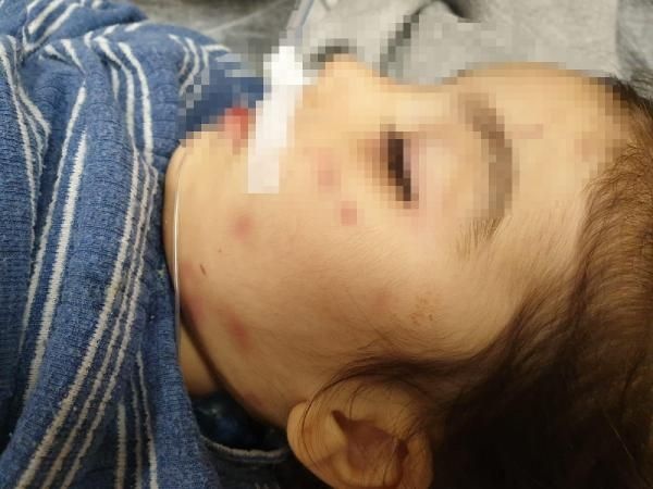 Şok gerçek ortaya çıktı!  Onu bu hale üvey annesi getirdi... 4