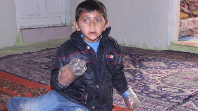 Ellerini plastik şişeye sokup bağlamak zorunda kaldılar! 6